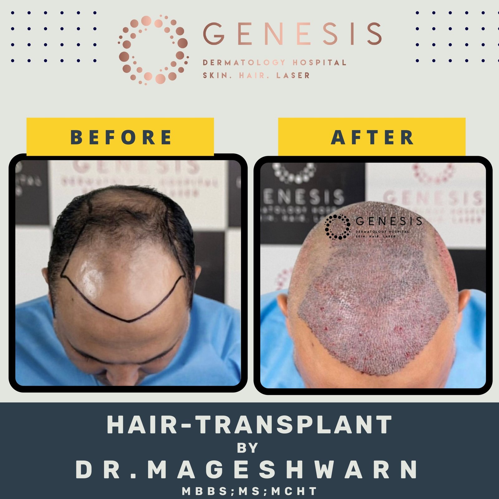 BEFORE-AFTER-1_page-0017-scaled.jpg