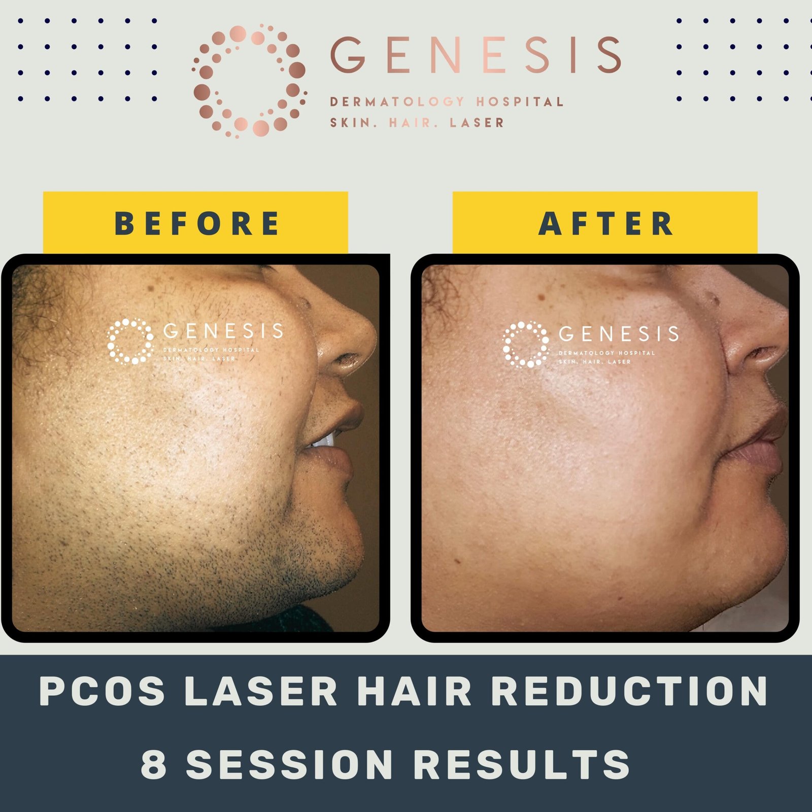 BEFORE-AFTER-1_page-0026-min-scaled.jpg