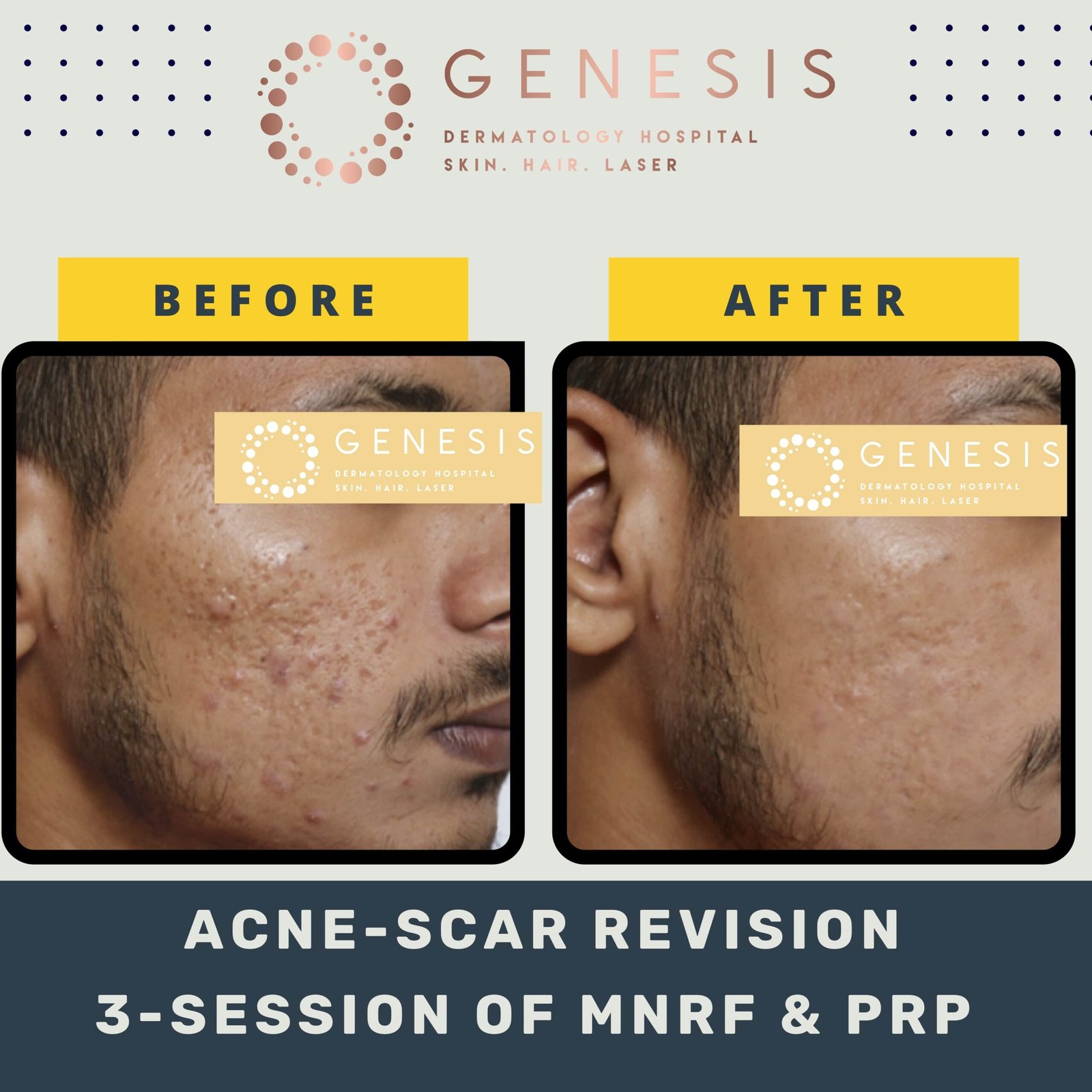 BEFORE-AFTER-1_page-0040-min-scaled.jpg