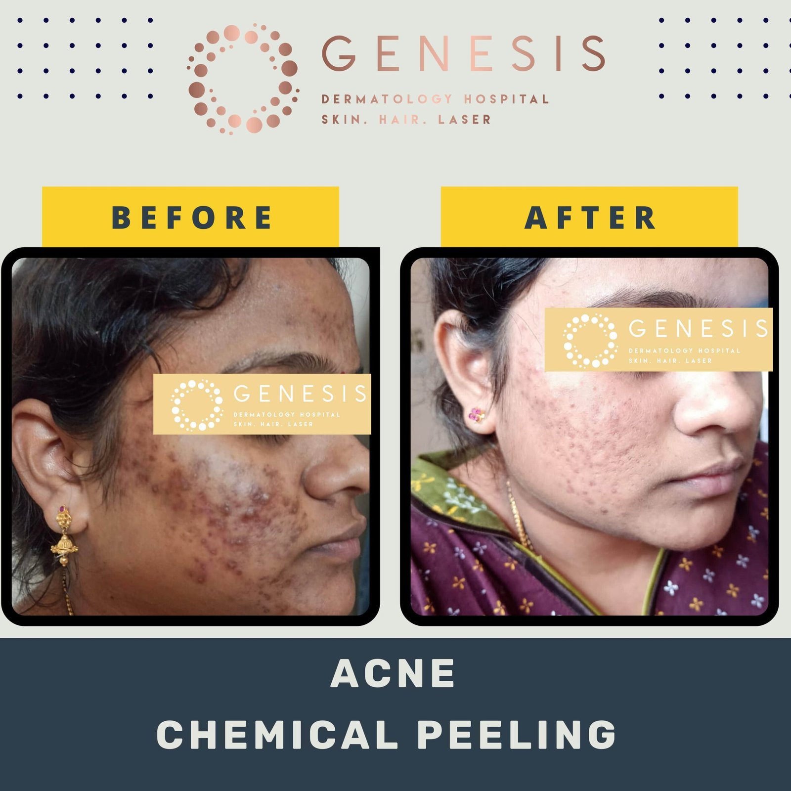 BEFORE-AFTER-1_page-0041-min-scaled.jpg