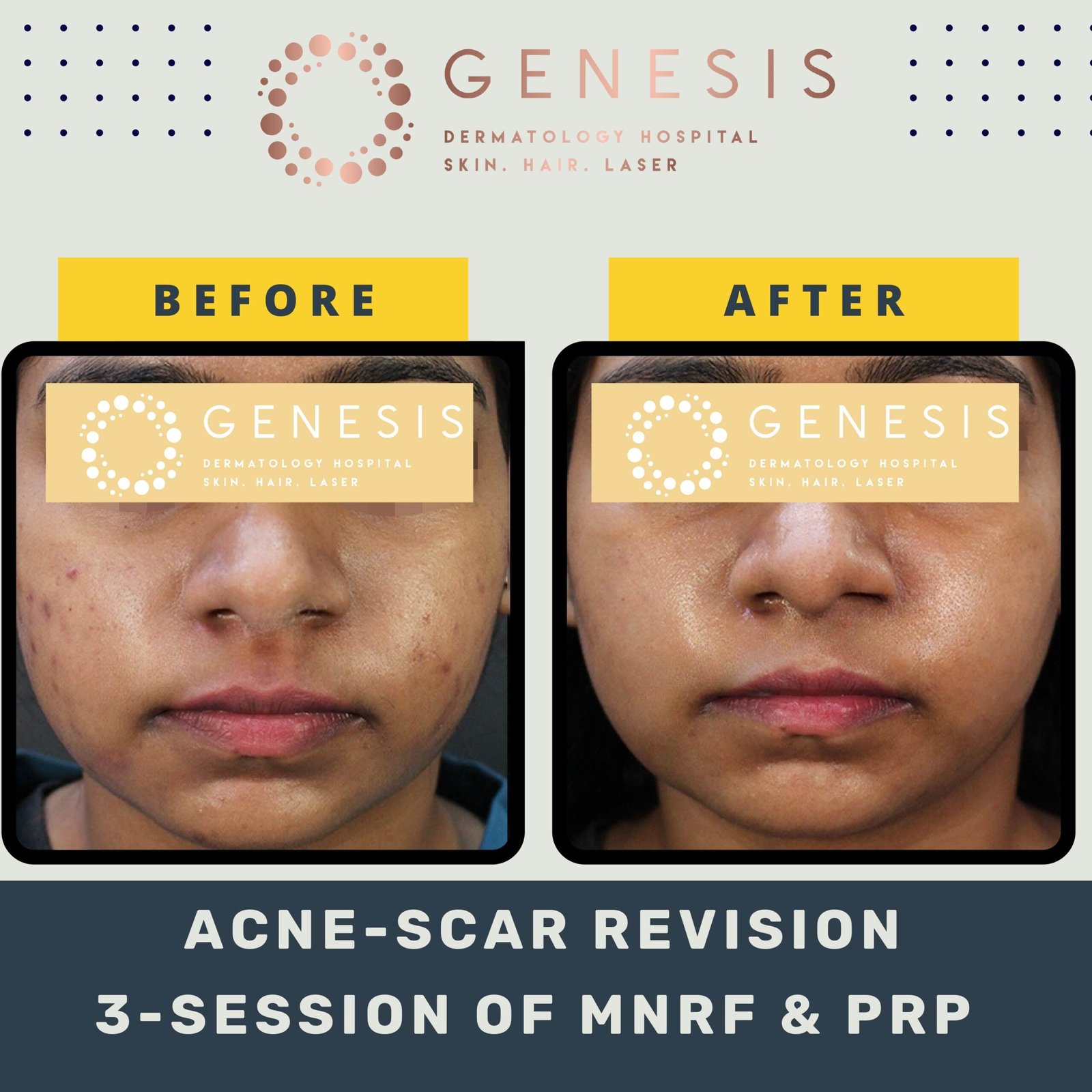 BEFORE-AFTER-1_page-0042-min-scaled.jpg