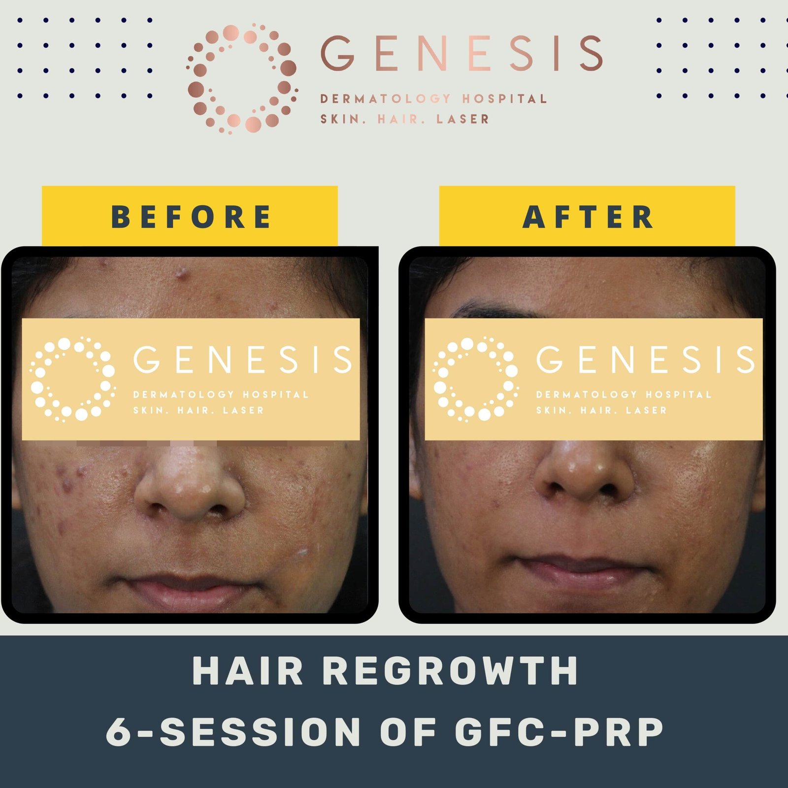 BEFORE-AFTER-1_page-0043-min-scaled.jpg