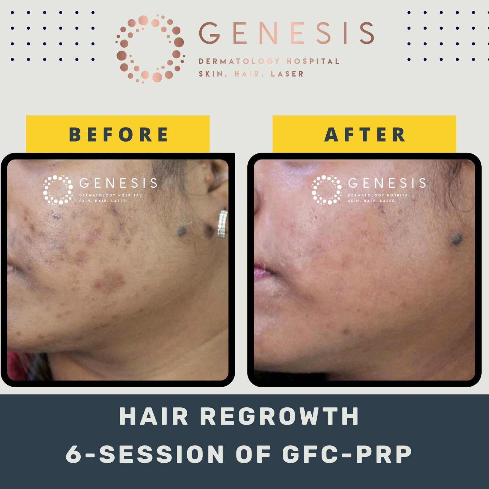 BEFORE-AFTER-1_page-0044-min-scaled.jpg