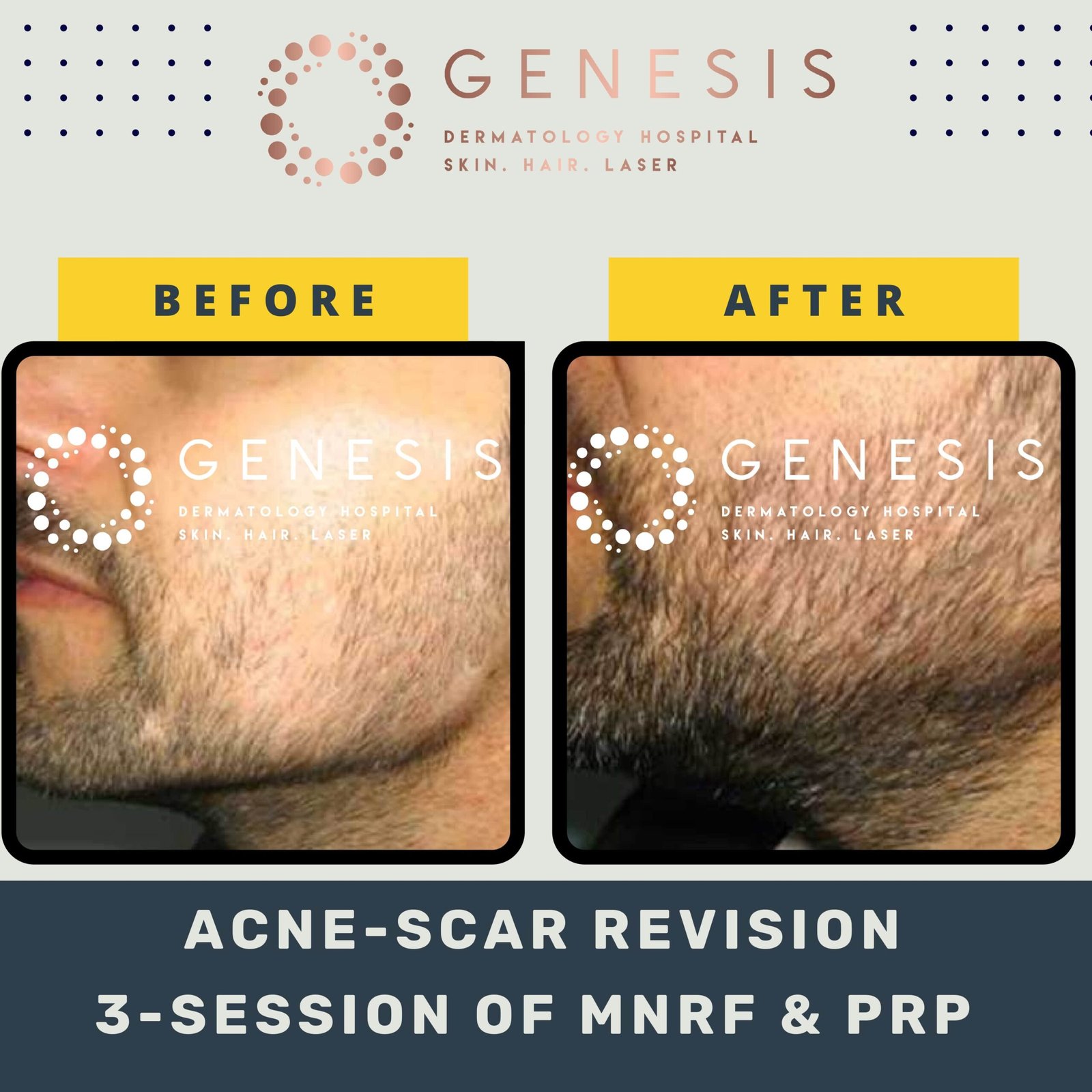 BEFORE-AFTER-1_page-0045-min-scaled.jpg