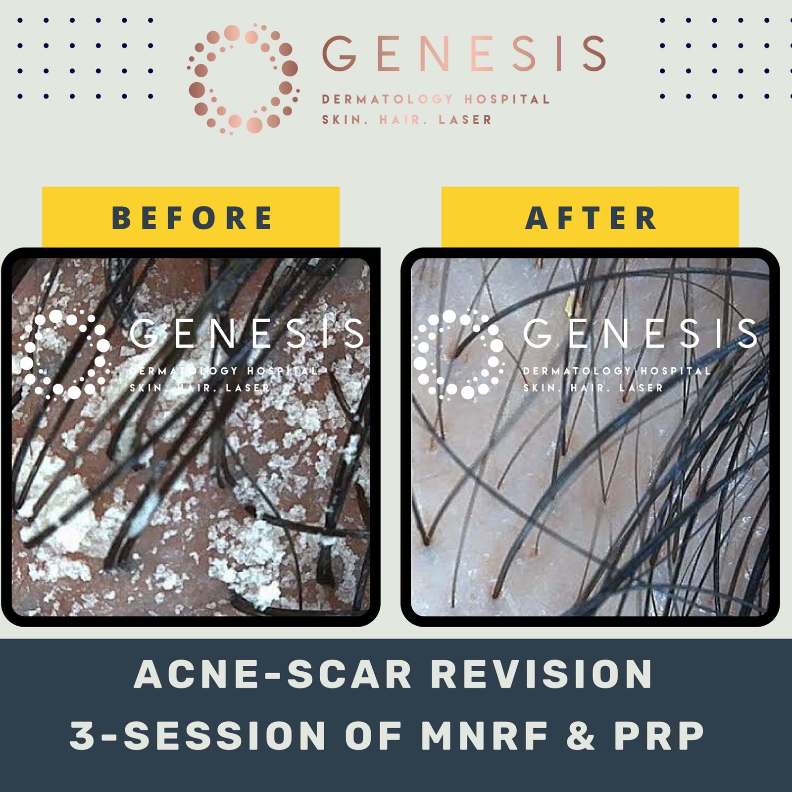 BEFORE-AFTER-1_page-0046-min-scaled.jpg