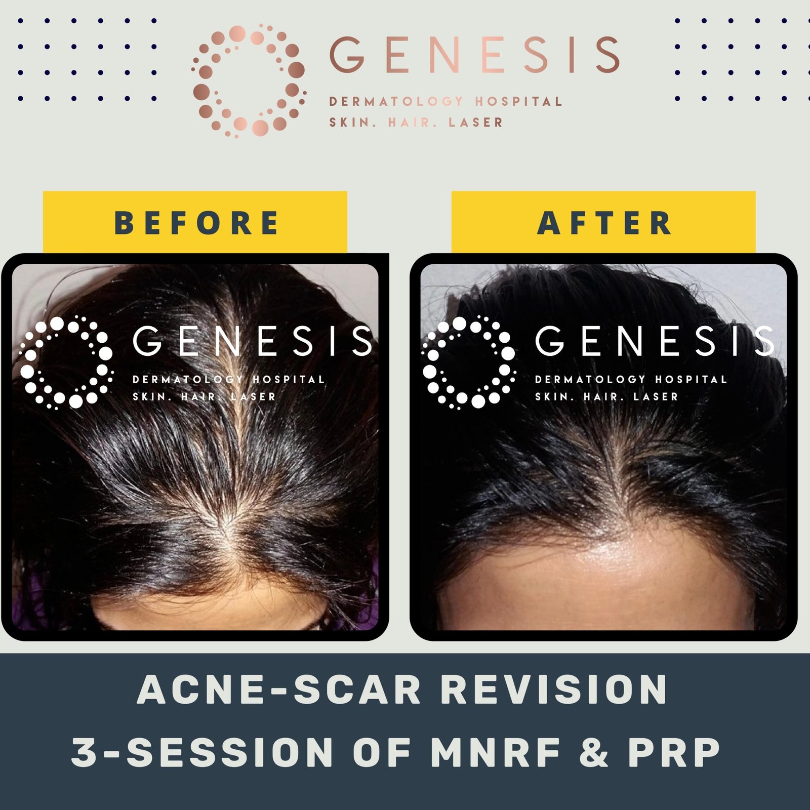 BEFORE-AFTER-1_page-0047-min-scaled.jpg