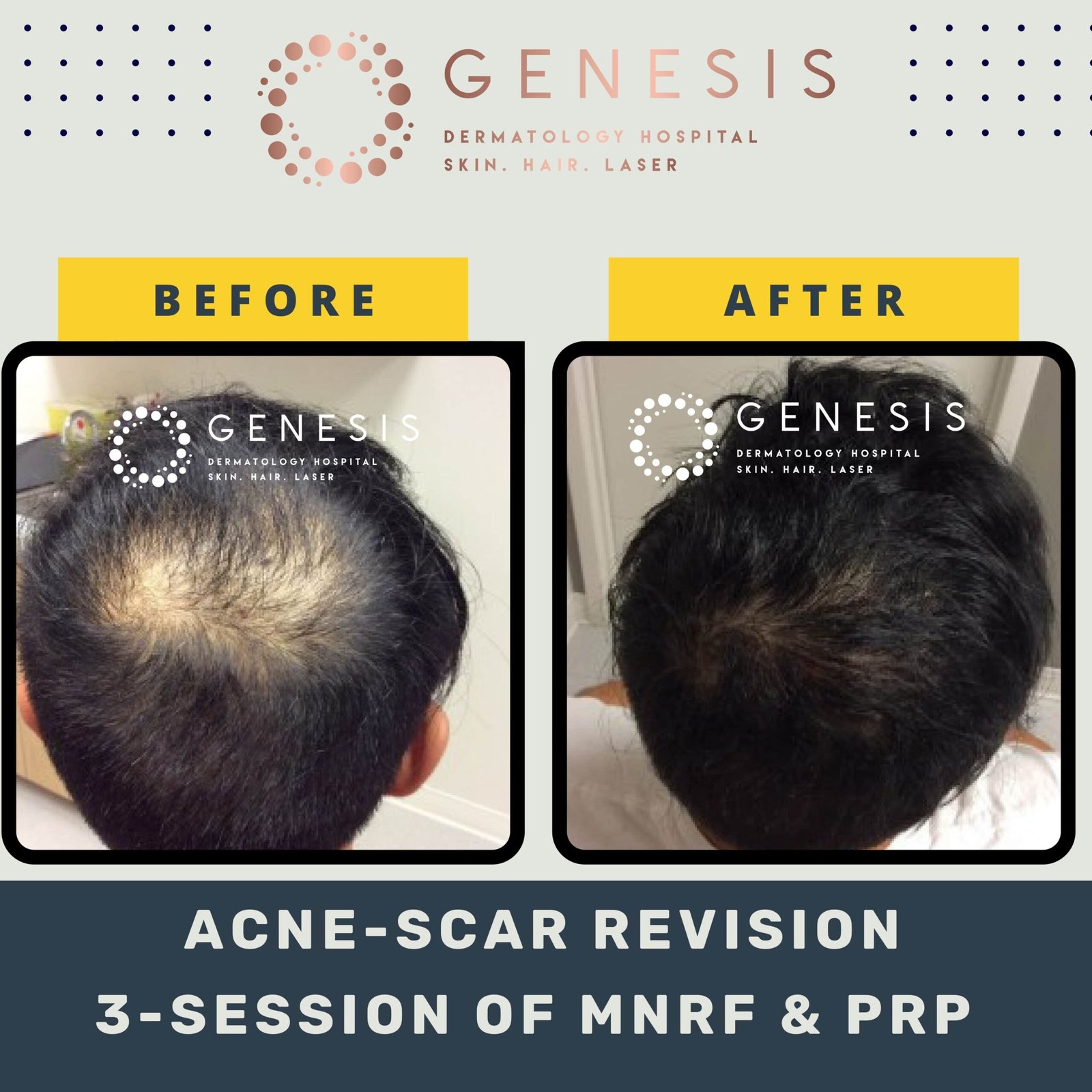 BEFORE-AFTER-1_page-0048-min-scaled.jpg