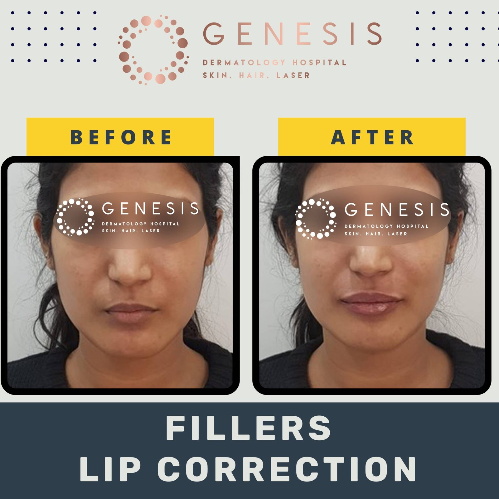 BEFORE-AFTER-1_page-0056-min-scaled.jpg