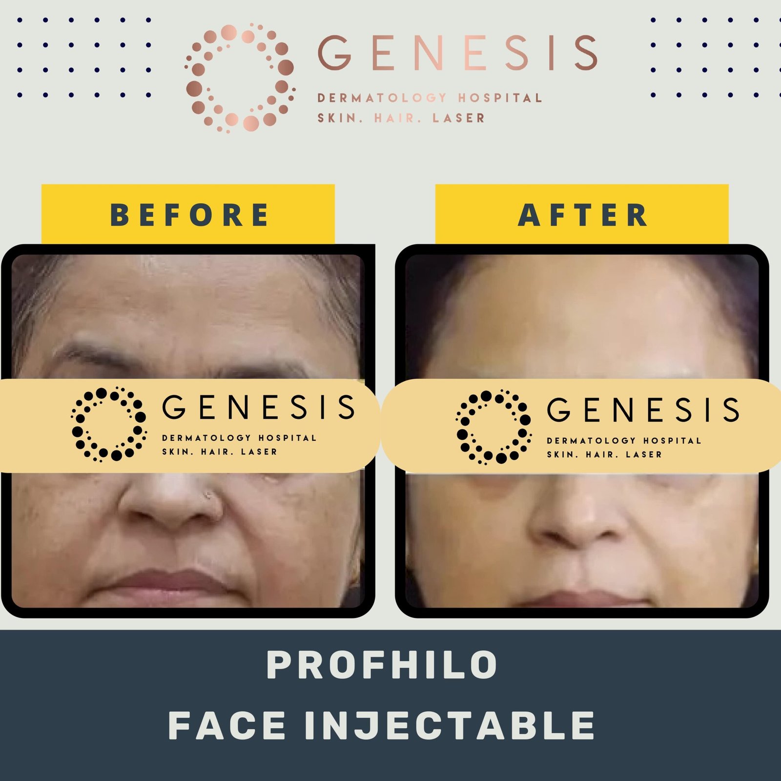 BEFORE-AFTER-1_page-0057-min-scaled.jpg