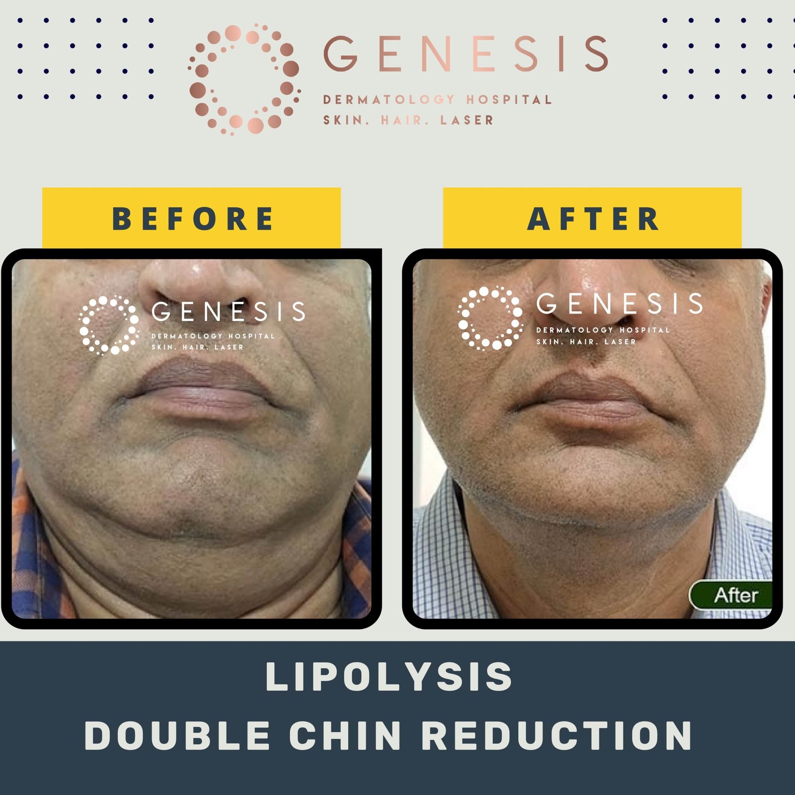 BEFORE-AFTER-1_page-0058-min-scaled.jpg