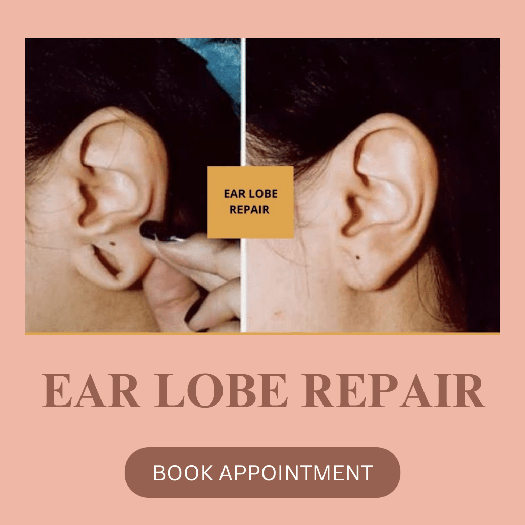 TMJ-Disorders-2.png