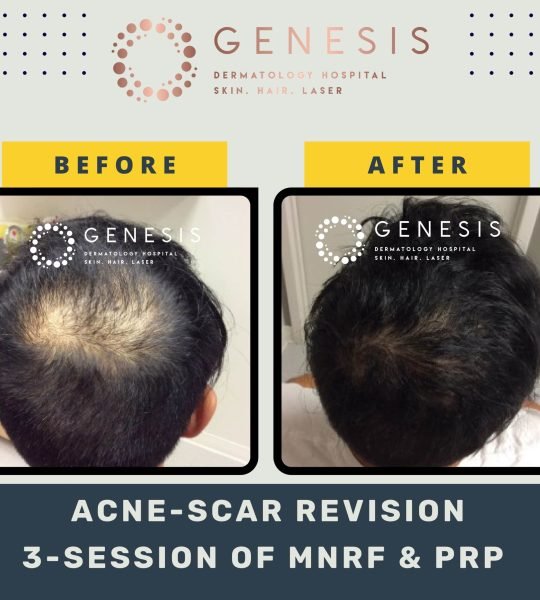 BEFORE-AFTER-1_page-0048-min-scaled.jpg